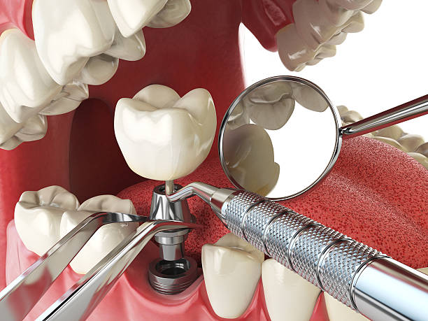 Best Emergency Cosmetic Dentistry (e.g., broken veneers) in Irwin, SC